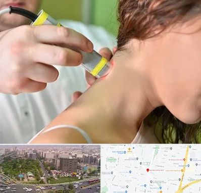 لیزر درمانی در آیت الله کاشانی