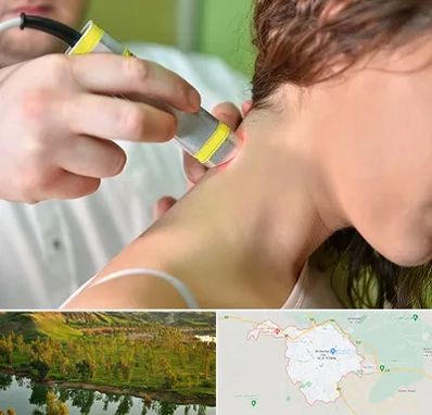 لیزر درمانی در بهبهان