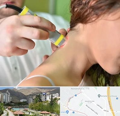 لیزر درمانی در شهر زیبا