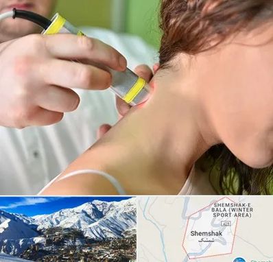 لیزر درمانی در شمشک