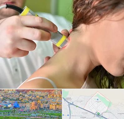 لیزر درمانی در رشدیه تبریز