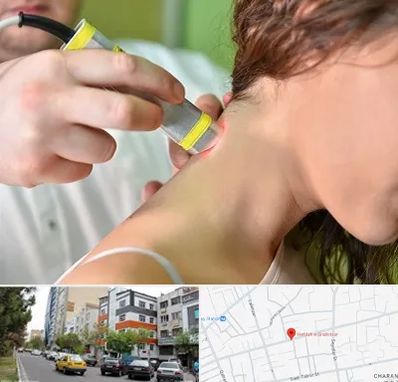 لیزر درمانی در هفده شهریور تبریز