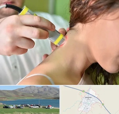 لیزر درمانی در دهگلان