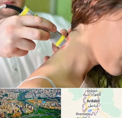لیزر درمانی در اردبیل