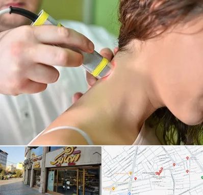 لیزر درمانی در عطاران قم