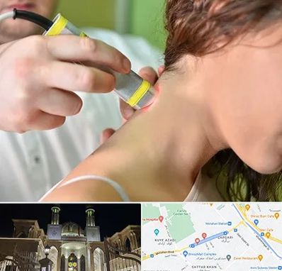 لیزر درمانی در زرگری شیراز