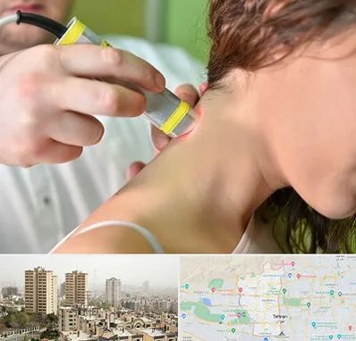 لیزر درمانی در منطقه 5 تهران