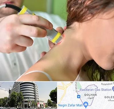 لیزر درمانی در قلهک