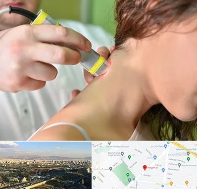 لیزر درمانی در هنگام