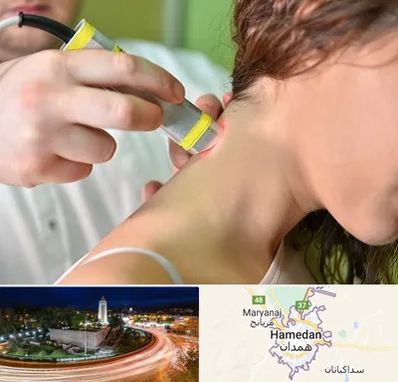 لیزر درمانی در همدان