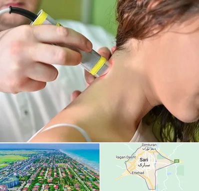 لیزر درمانی در ساری