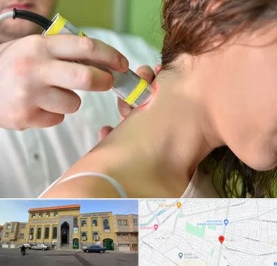 لیزر درمانی در زنبیل آباد قم