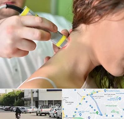 لیزر درمانی در قدوسی شرقی شیراز