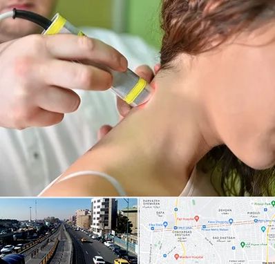 لیزر درمانی در پیروزی