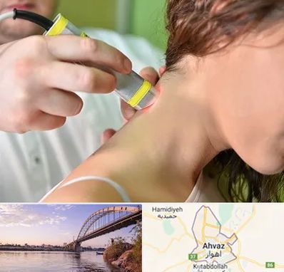 لیزر درمانی در اهواز