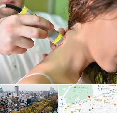 لیزر درمانی در بلوار کشاورز