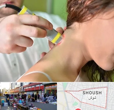 لیزر درمانی در شوش
