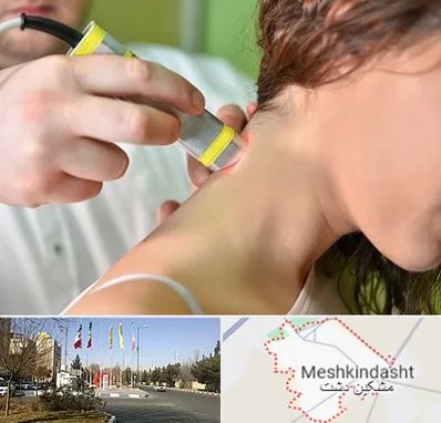 لیزر درمانی در مشکین دشت