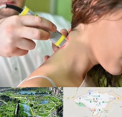 لیزر درمانی در بجنورد