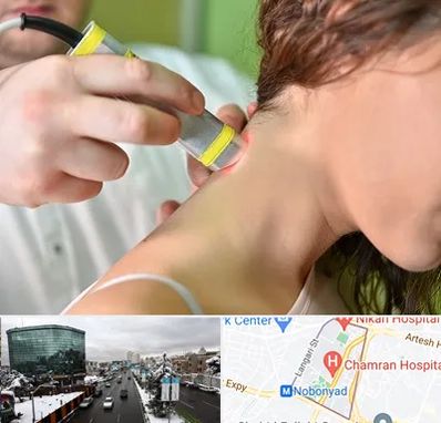 لیزر درمانی در اقدسیه