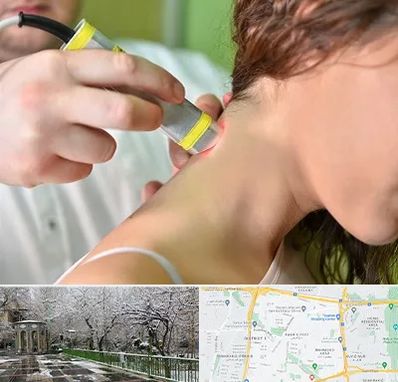 لیزر درمانی در باغ فیض