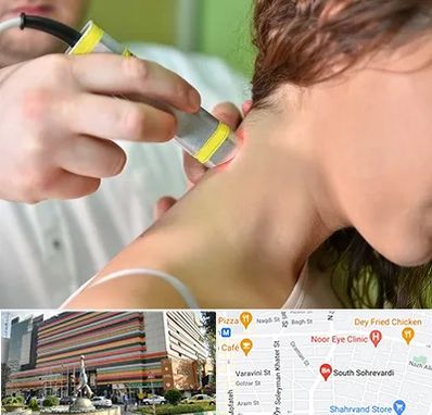 لیزر درمانی در سهروردی