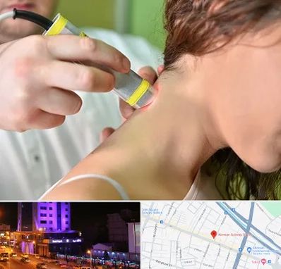 لیزر درمانی در آبرسان تبریز