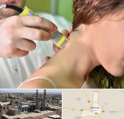 لیزر درمانی در سبزوار