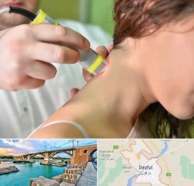 لیزر درمانی در دزفول