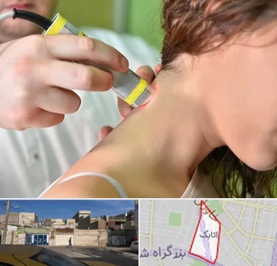 لیزر درمانی در اتابک