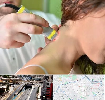 لیزر درمانی در ستارخان شیراز