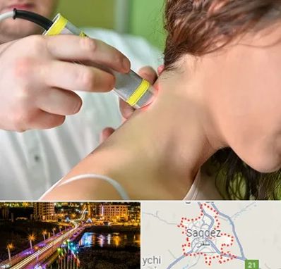 لیزر درمانی در سقز