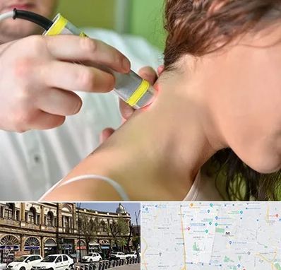 لیزر درمانی در منطقه 11 تهران