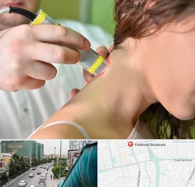 لیزر درمانی در بلوار فرحزادی