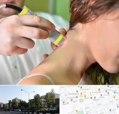 لیزر درمانی در میدان کاج