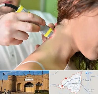 لیزر درمانی در ایرانشهر