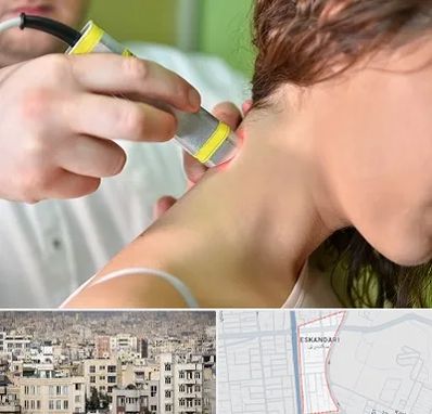 لیزر درمانی در اسکندری