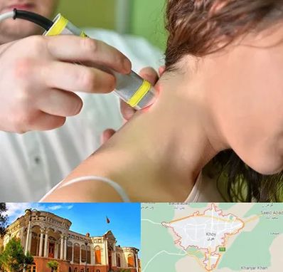 لیزر درمانی در خوی