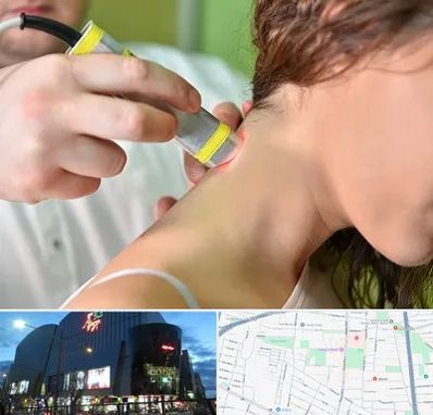 لیزر درمانی در بلوار اباذر