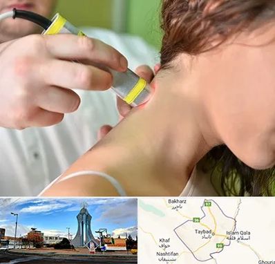 لیزر درمانی در تایباد