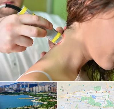 لیزر درمانی در منطقه 22 تهران