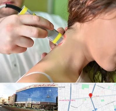 لیزر درمانی در نصف راه تبریز