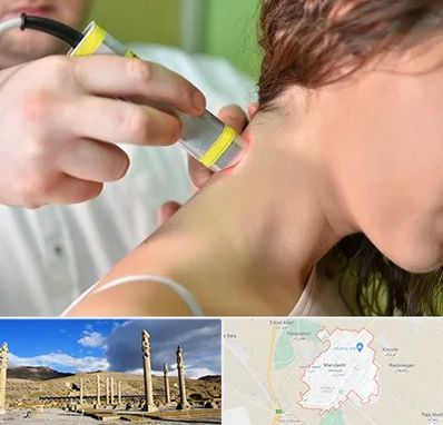 لیزر درمانی در مرودشت