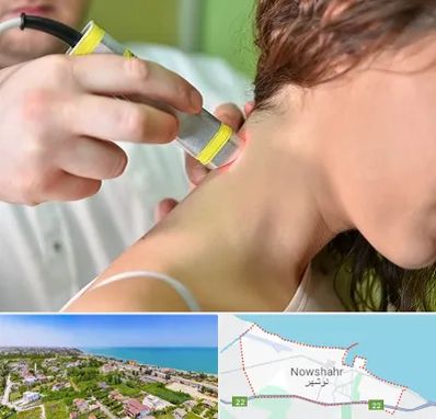 لیزر درمانی در نوشهر