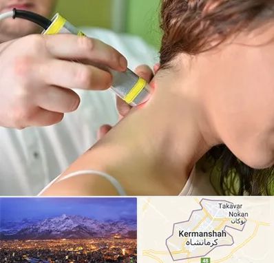 لیزر درمانی در کرمانشاه