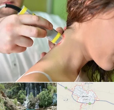 لیزر درمانی در شیروان
