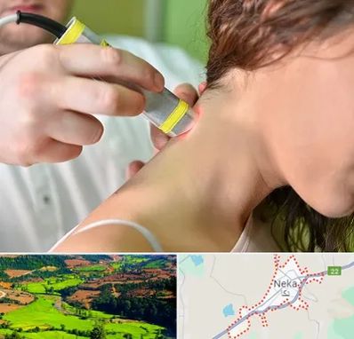 لیزر درمانی در نکا