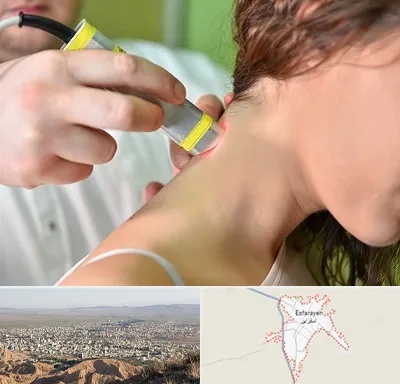 لیزر درمانی در اسفراین