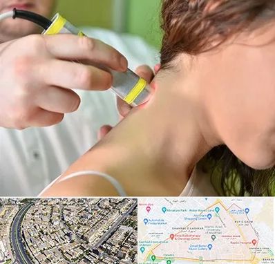 لیزر درمانی در شهرک غرب مشهد