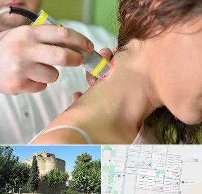 لیزر درمانی در مرداویج اصفهان